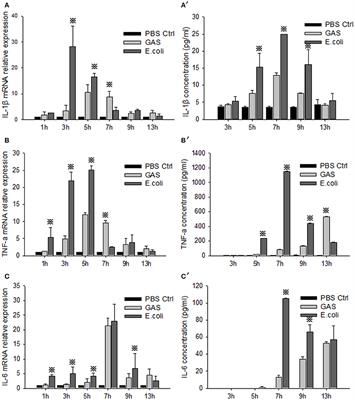 M Protein of Group a Streptococcus Plays an Essential Role in Inducing High Expression of A20 in Macrophages Resulting in the Downregulation of Inflammatory Response in Lung Tissue